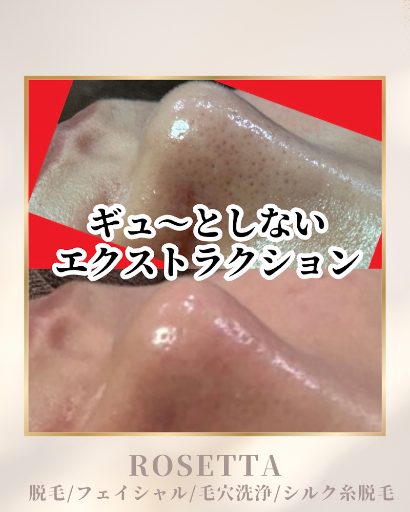 フェイシャル&脱毛 ROSETTA【ロゼッタ 】の店内写真