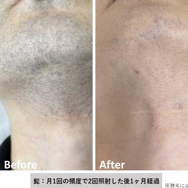 メンズ脱毛Lisseの店内写真